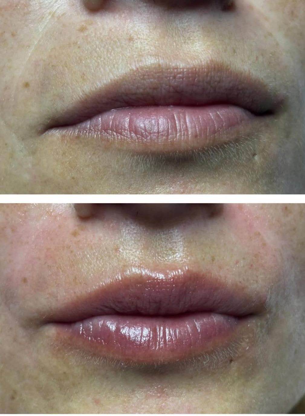 Antes / Después: Hidratación de labios: labios más hidratados y con mejor color